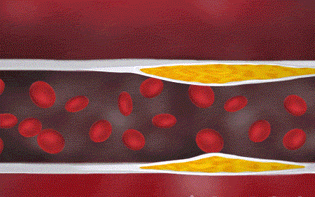 1718870581515353.gif 治疗前.gif